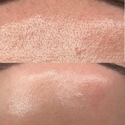 Filter Skin Instant (pores et cicatrice)