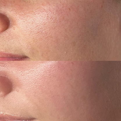 Filter Skin Instant (pores et cicatrice)